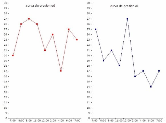 Gráficos de variación de presión ocular durante el día