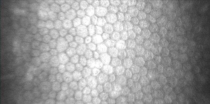 Imagen de células endoteliales corneales